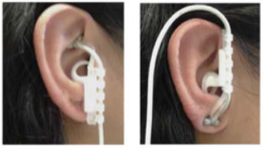 Person with electrode in ear.